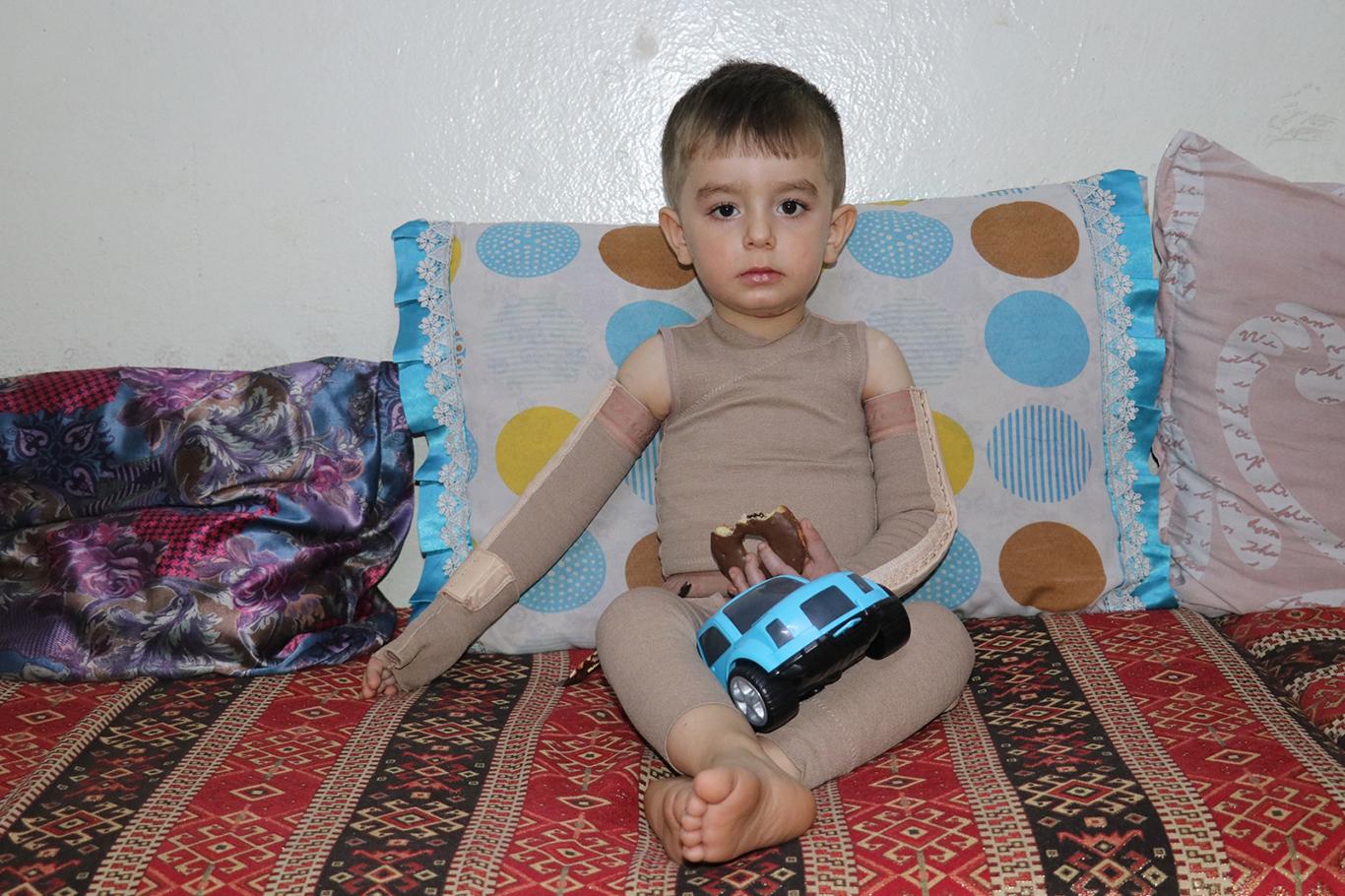 ​Vücudu yanan küçük çocuğa yardım eli uzatıldı